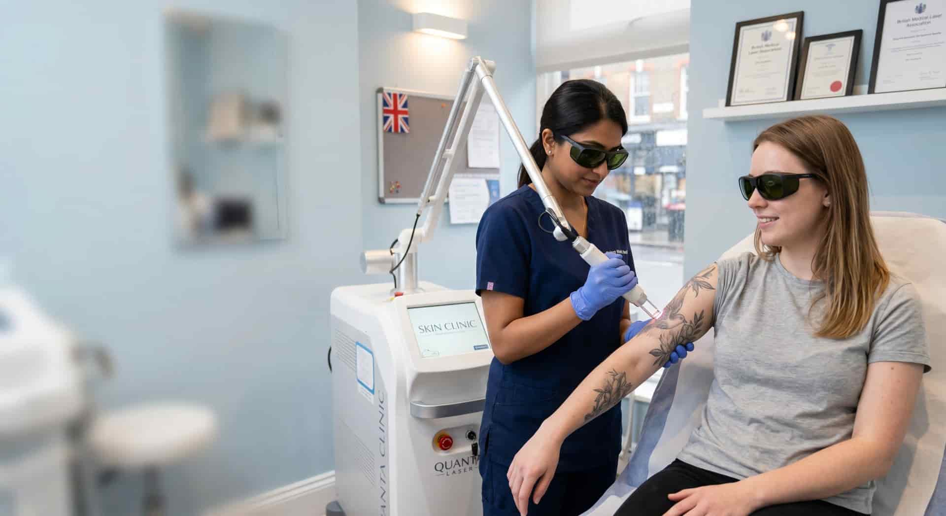 Tattoo Removals